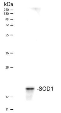 SOD1 aa 24-39 | superoxide dismutase 1, soluble in the group Antibodies Human Cell Biology / Human Oxidative Stress at Agrisera AB (Antibodies for research) (AS09 535)